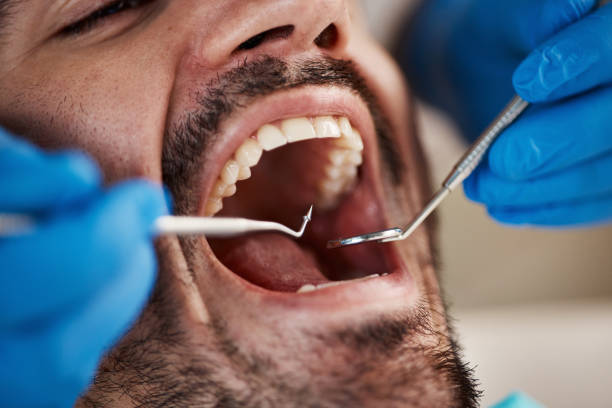 Best Cracked Tooth Emergency Dentist  in Pomona, NY