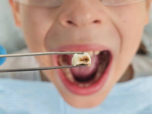 Best Emergency Pediatric Dentist  in Pomona, NY